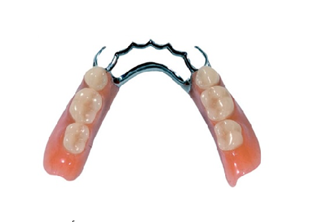 Hàm tháo lắp 17 HTL4